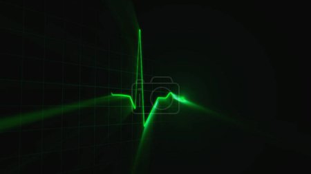 Foto de Palpitaciones de la frecuencia cardíaca. Línea de corazón ECG. Fondo de electrocardiograma verde. Representación 3D del gráfico de frecuencia cardíaca. Latidos cardíacos en la pantalla del monitor del cardiógrafo. El concepto de vida, salud, medicina - Imagen libre de derechos