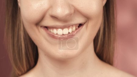 Téléchargez les photos : Belle sourire féminin en bonne santé de près. Santé dentaire, blanchiment, prothèses et soins - en image libre de droit