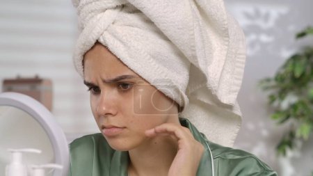 Photo for A young woman with problematic facial skin looks disappointedly in the mirror. A woman after a shower, wearing a white bath towel over her head and green silk pajamas, examines her face in a close up - Royalty Free Image