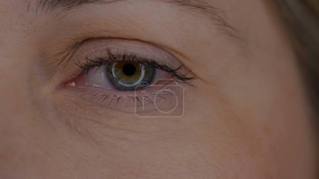 Téléchargez les photos : Œil d'une jeune femme macro shot. pupille élargie, en raison de l'utilisation prolongée de gadgets. Syndrome des yeux secs. Le concept de santé, de beauté et de soins - en image libre de droit