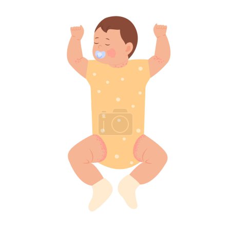 Illustration for Pediatric Eczema or Atopic Dermatitis in infants and children. Baby with diaper rash, skin rash, allergy. Redness of skin in children.Dermatological problems. Vector illustration - Royalty Free Image