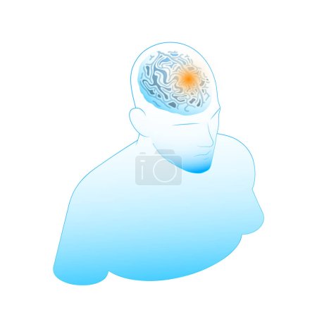 Illustration for Neurology and neural surgery isometric composition with medical innovations isolated image vector illustration - Royalty Free Image