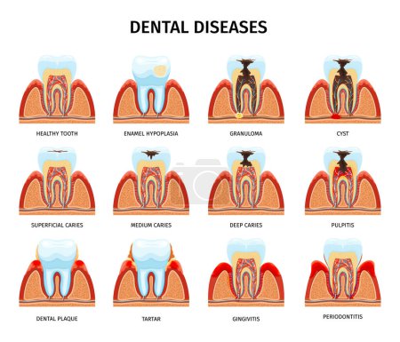 Teeth anatomy problems set with isolated compositions of tooth in jaw healthy and damaged with text vector illustration