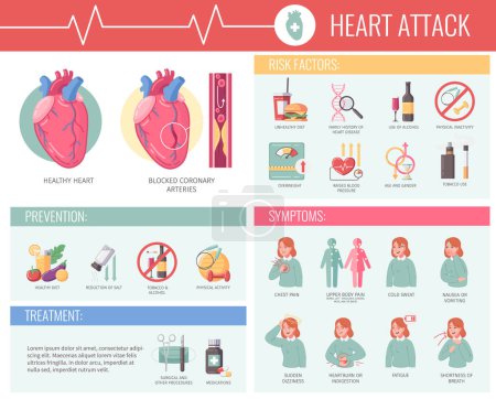 Ilustración de Infografías de dibujos animados de ataque cardíaco con prevención de enfermedades e ilustración de vectores de síntomas - Imagen libre de derechos