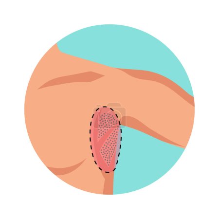 Illustration for Armpit hair removal process flat round icon vector illustration - Royalty Free Image