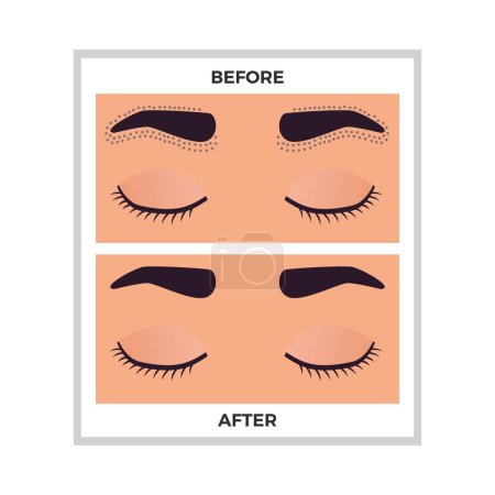 Illustration for Hair removal eyebrows area before and after flat vector illustration - Royalty Free Image