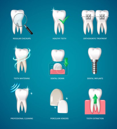 Traitement des dents icônes réalistes avec implants dentaires et placages artificiels illustration vectorielle isolée