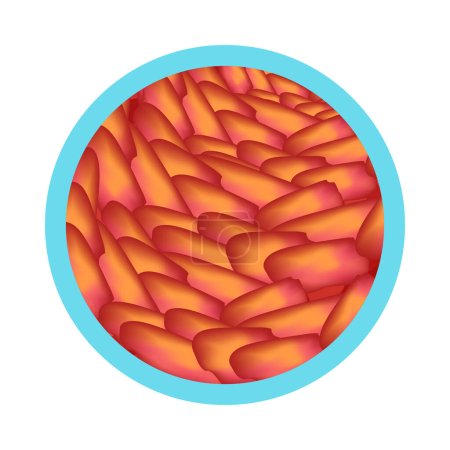 Téléchargez les illustrations : Icône ronde de symptôme de gastrite en illustration vectorielle de style plat - en licence libre de droit