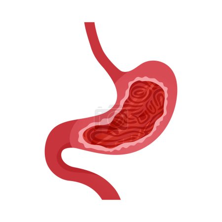Téléchargez les illustrations : Symptôme de gastrite icône plate sur fond blanc illustration vectorielle - en licence libre de droit