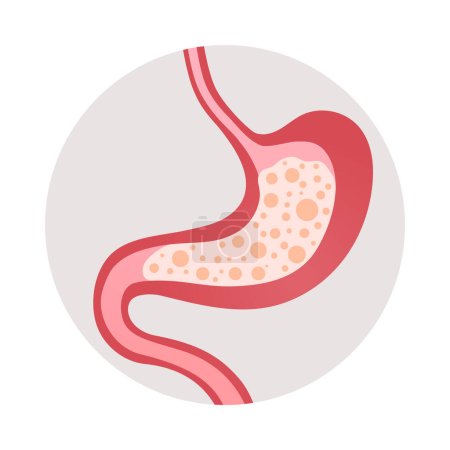 Téléchargez les illustrations : Lourdeur dans l'estomac gastrite symptôme plat icône vectorielle illustration - en licence libre de droit