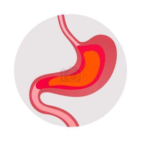 Téléchargez les illustrations : Douleur dans l'estomac gastrite symptôme plat icône ronde illustration vectorielle - en licence libre de droit