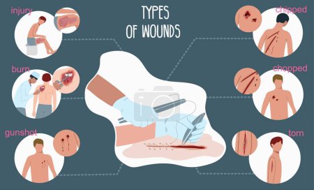 Illustration for Wound people flat infographic set of round compositions showing various wound types with editable text captions vector illustration - Royalty Free Image