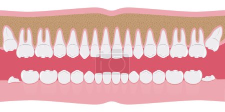 Illustration for Healthy white human teeth in a row. Beautiful, even teeth with roots. The gums are cut to the bone. Structure of the jaw.Infographic elements for dentists and orthodontists. A flat-style banner.Vector - Royalty Free Image