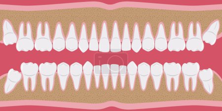 Illustration for Healthy white human teeth in a row. Beautiful, even teeth with roots. The gums are cut to the bone. Structure of the jaw. Infographic elements for dentists and orthodontists. flat-style banner. Vector - Royalty Free Image