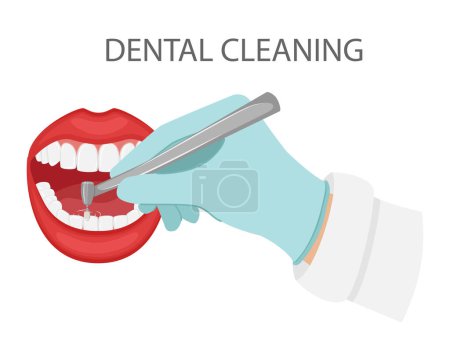 Illustration for Dental cleaning of teeth. A gloved hand holds a dental polishing drill.Cosmetic and aesthetic dentistry. Professional appointment with dentist.Open mouth with teeth and lips. flat vector illustration - Royalty Free Image