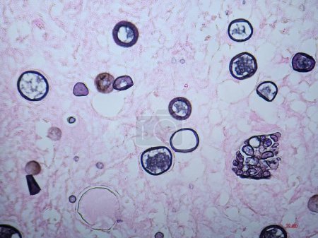 Photo for Coccidioides imitis spherules and endospores on tissue silver stain - Royalty Free Image