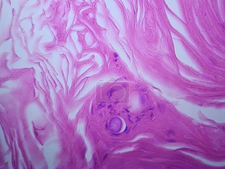 Photo for Coccidioides imitis spherule on tissue biopsy specimen - Royalty Free Image