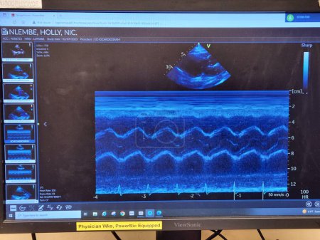Photo for Echocardiogram triangular targeting map and waveforms - Royalty Free Image
