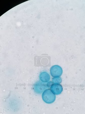 Photo for Coccidioides imitis spherules and endospores stained blue - Royalty Free Image