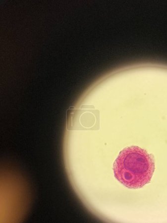 Foto de Organismo encapsulado por Crytpococcus neoformans intracelular - Imagen libre de derechos