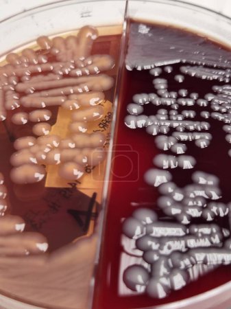 Photo for Klebsiella bacteria petri dish - blood and Macconkey agar - Royalty Free Image