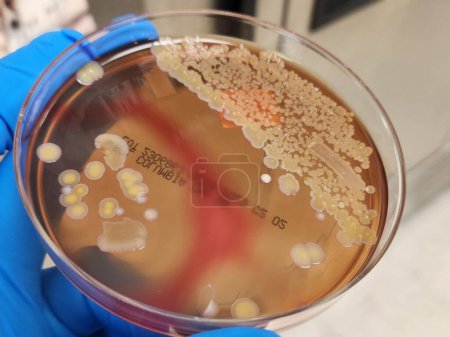 Colonias bacterianas de Acinetobacter en placa de agar: resistentes a los antimicrobianos