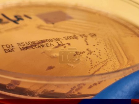 Petri dish with colonies of Shigella flexneri