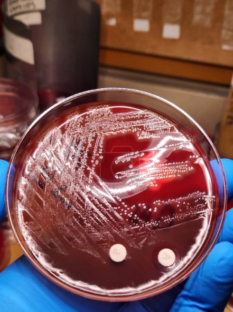 Foto de Grupo G Colonias bacterianas estreptocócicas en agar - Imagen libre de derechos