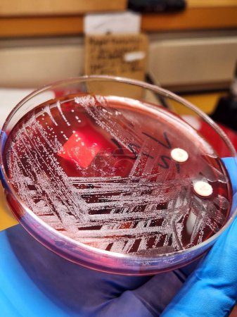 Group G Streptococcal bacterial colonies on agar
