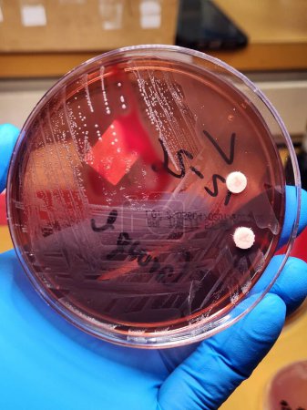 Foto de Grupo G Colonias bacterianas estreptocócicas en agar - Imagen libre de derechos