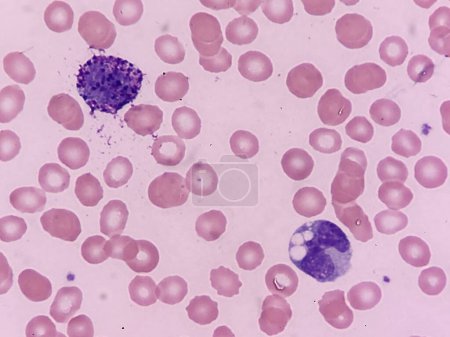 Basophil und neutrophil auf peripheren Blutausstrichen
