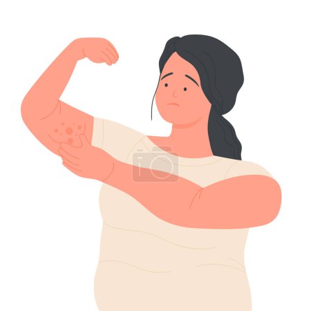 Illustration for Unhappy girl showing cellulite. Overweight women, unhealthy lifestyle vector illustration - Royalty Free Image