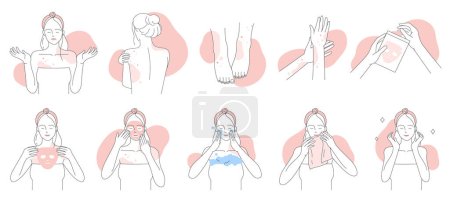 Ilustración de Allergy, symptoms and treatment line icons set vector illustration. Hand drawn girls suffer from allergic dermatitis and skin atopy, apply facial mask to care itchy sensitive skin with irritation - Imagen libre de derechos