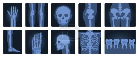 Ilustración de Películas de rayos X del conjunto del cuerpo humano, radiografía e ilustración de vectores de anatomía. Escaneos médicos de roentgen aislados de dibujos animados con siluetas de huesos de esqueleto, articulación y articulación de piernas y manos - Imagen libre de derechos