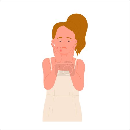 Illustration for Sad girl with facial skin allergy. Rash on face, allergic reaction, acne pimples flat vector illustration - Royalty Free Image