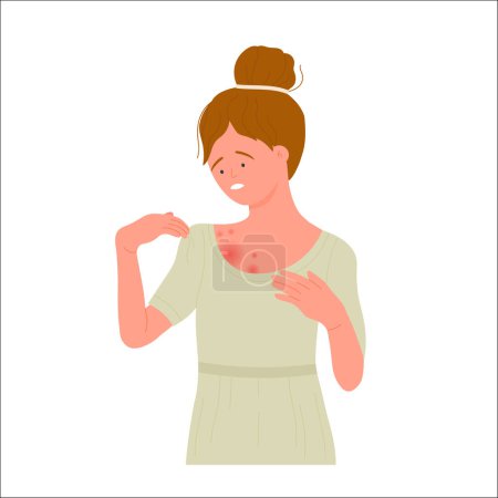 Illustration for Worried girl with red rash on her body. Allergic itchy reaction, atopic dermatitis flat vector illustration - Royalty Free Image