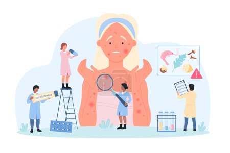 Illustration for Diagnosis of allergy at examination with allergist vector illustration. Cartoon tiny people with magnifying glass research allergic symptoms on skin of woman, doctors advise antihistamine treatment - Royalty Free Image