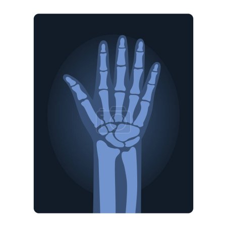 Illustration for Xray shot of human hand. Medical injury test, body radiography cartoon vector illustration - Royalty Free Image