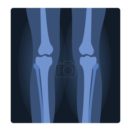 Röntgenaufnahme menschlicher Knie. Medizinische Verletzungstest, Körper Röntgen Cartoon Vektor Illustration