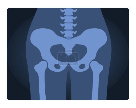 Xray shot of human pelvis. Medical skeleton test, body radiography cartoon vector illustration