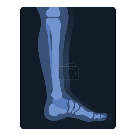 Illustration for Xray shot of human leg. Medical skeleton test, body radiography cartoon vector illustration - Royalty Free Image