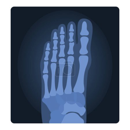 Rayos X del pie humano. Prueba de esqueleto médico, radiografía corporal ilustración vectorial de dibujos animados