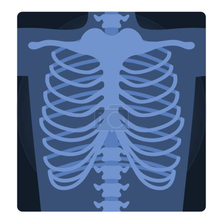 Illustration for Medical xray scan of human chest. Medical skeleton test, body radiography cartoon vector illustration - Royalty Free Image