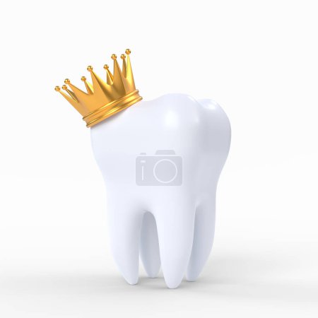 Foto de Diente humano blanco coronado con una corona de oro aislada sobre fondo blanco. Ilustración de representación 3D - Imagen libre de derechos