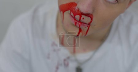 Photo for Consequences of bullying in the team, the broken face of the guy. Bloodied nose. He blinks his eyes, fear. Shock state. - Royalty Free Image