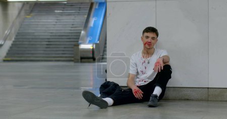 Photo for The broken face of a guy in the subway crossing of the city. He sits on the floor, waiting for help. The result of a street fight. CZ, Prague, Republici, 1.10.22 - Royalty Free Image