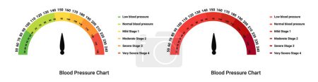 Escala de presión arterial. Prueba de etapa con indicadores de flechas y diagramas de hipo e hipertensión con infografías gráficas de medición de vectores cardiovasculares