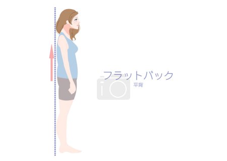 Téléchargez les illustrations : Illustration d'une femme en posture dos plat vue de côté - en licence libre de droit