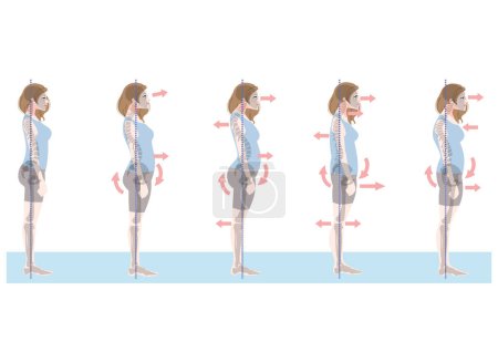 Illustration for Clip art set of woman in bad posture seen from the side - Royalty Free Image