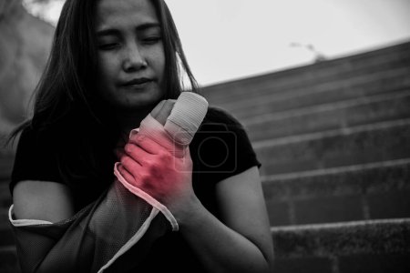 Foto de A beautiful Asian girl broke her arm and splinted,Woman accidentally falls, arms hit the ground, causing fractures, - Imagen libre de derechos